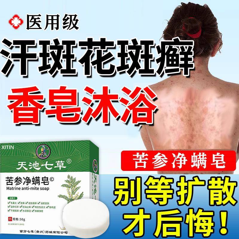 汗斑花斑快癣专用沐浴露香皂硫磺皂速消白斑马拉色菌感染止痒UU昌