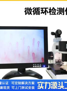 专业高清微循环检测仪检测甲壁微循环/人体亚健康SGO-XW8000