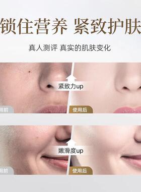 胶原蛋白法令纹抬头纹液态精华
