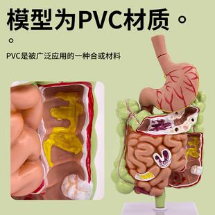 人体胃冠状剖面解剖放大病理胃模型胃的穿孔病态胃模型消化科