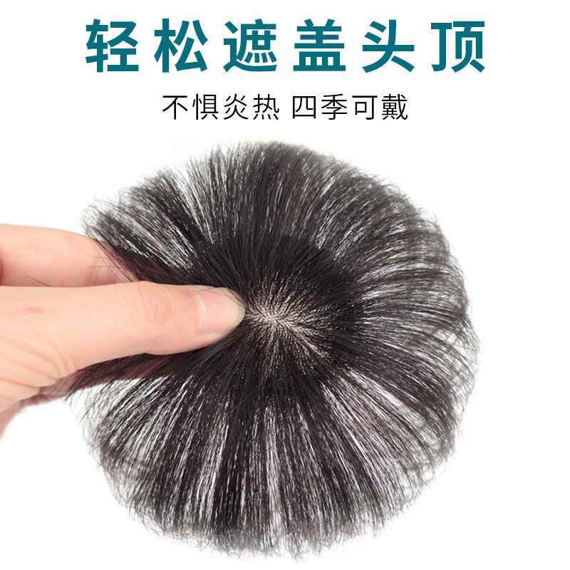 头顶头发稀少发顶假发贴片补发缝填充轻薄少量增发隐形无痕自然补
