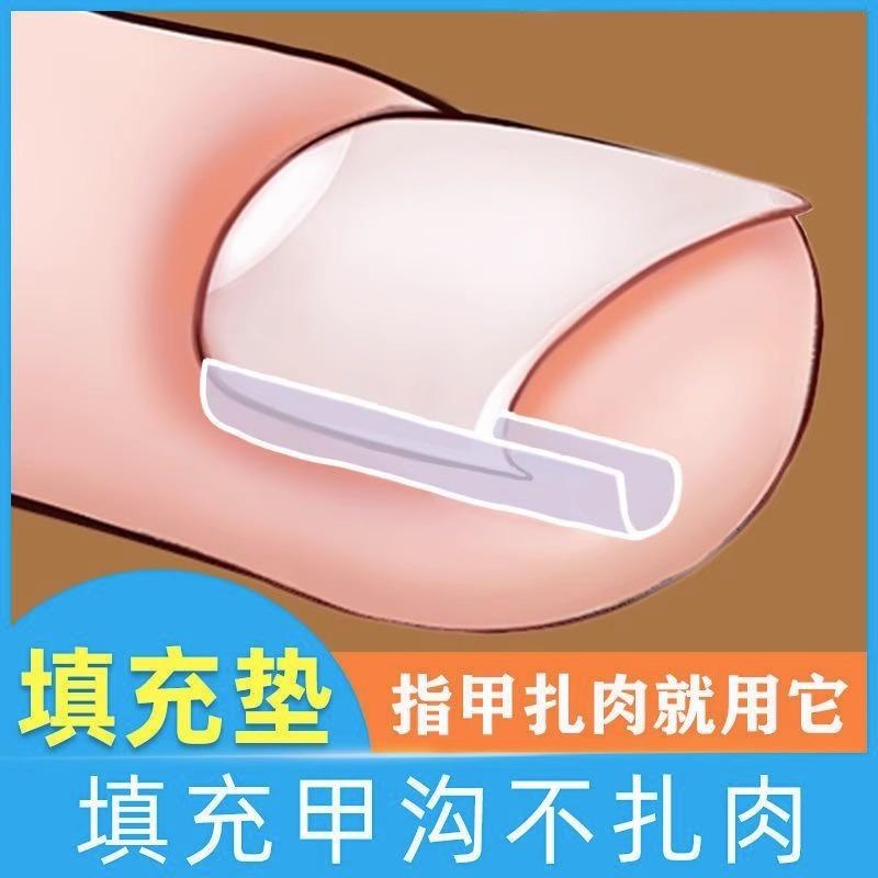 矫正器填充指甲隔离纠正美甲工具