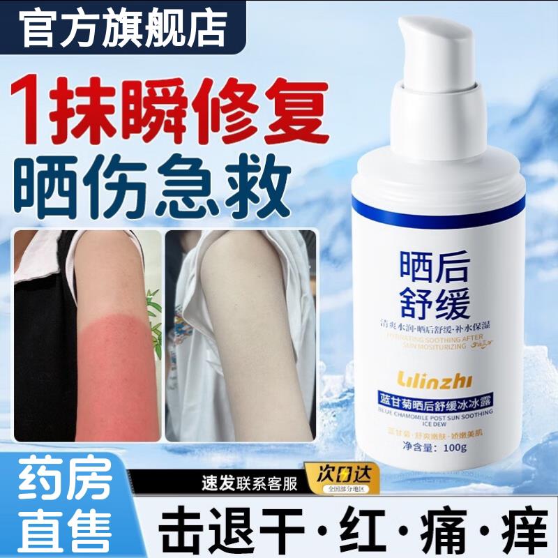 皮肤晒伤晒后复凝胶儿童军训晒伤屏障修修护紫外线晒伤脱皮发痒aw