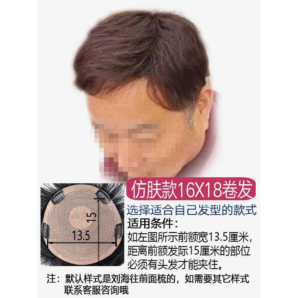 高档男士补发发块头脱顶秃顶无痕隐形发片额地发中前海谢顶真发假