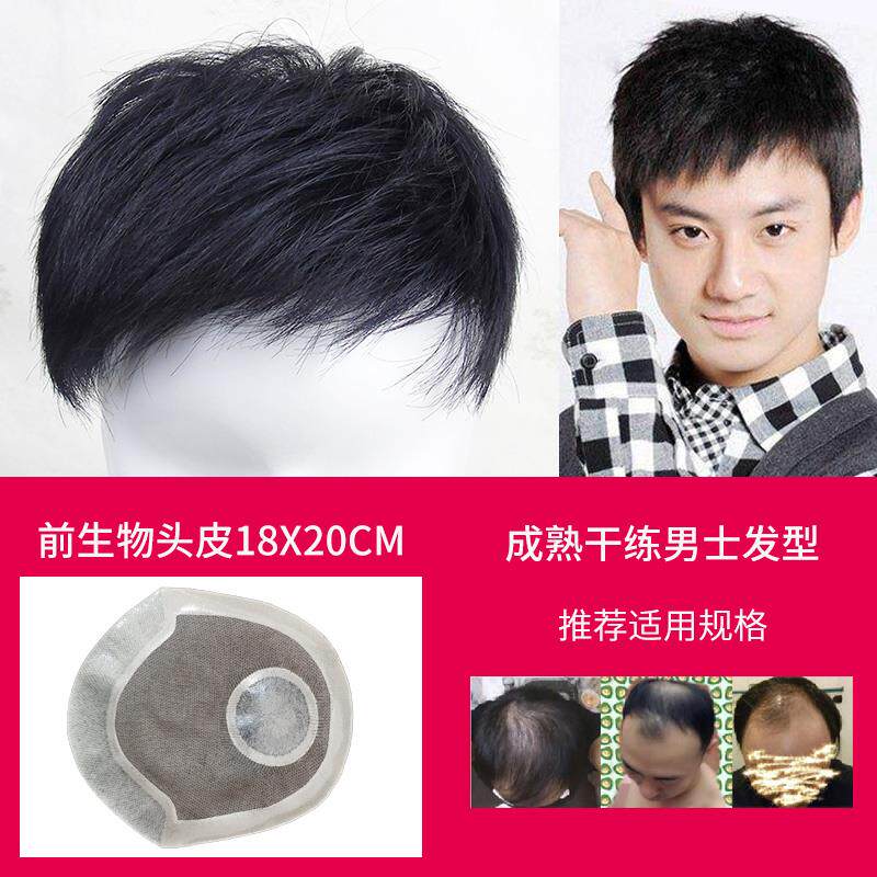 正品发假发男版帅气顶补发片男无痕隐形假片前韩额真发际线 线生