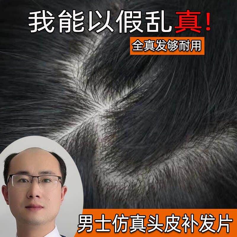 假发男士彷真头皮双递针头顶秃顶补发片真人发丝织发隐形无痕逼真