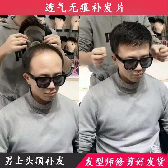 假发男士短发前额隐形补发片中老年假发真发男秃顶无痕逼真假发片