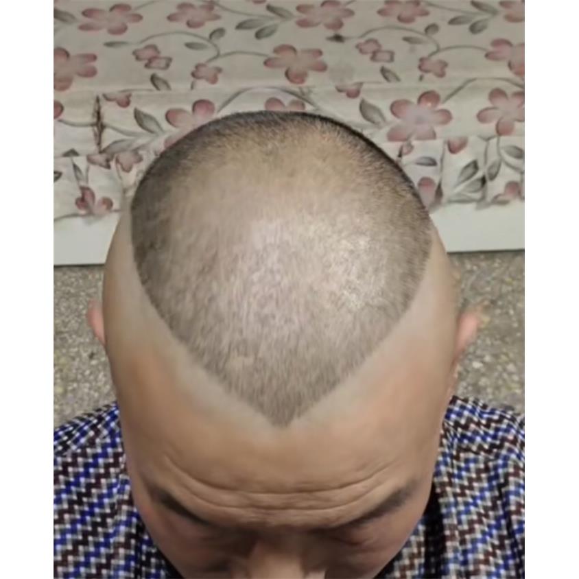 郭德纲成人理发模具同款头型大人发型郭德纲桃心短发剃头辅助神器