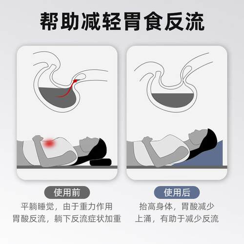 2U8K床头靠垫大靠背角胃食管防F76965M7斜流斜坡三腿垫老人躺孕反