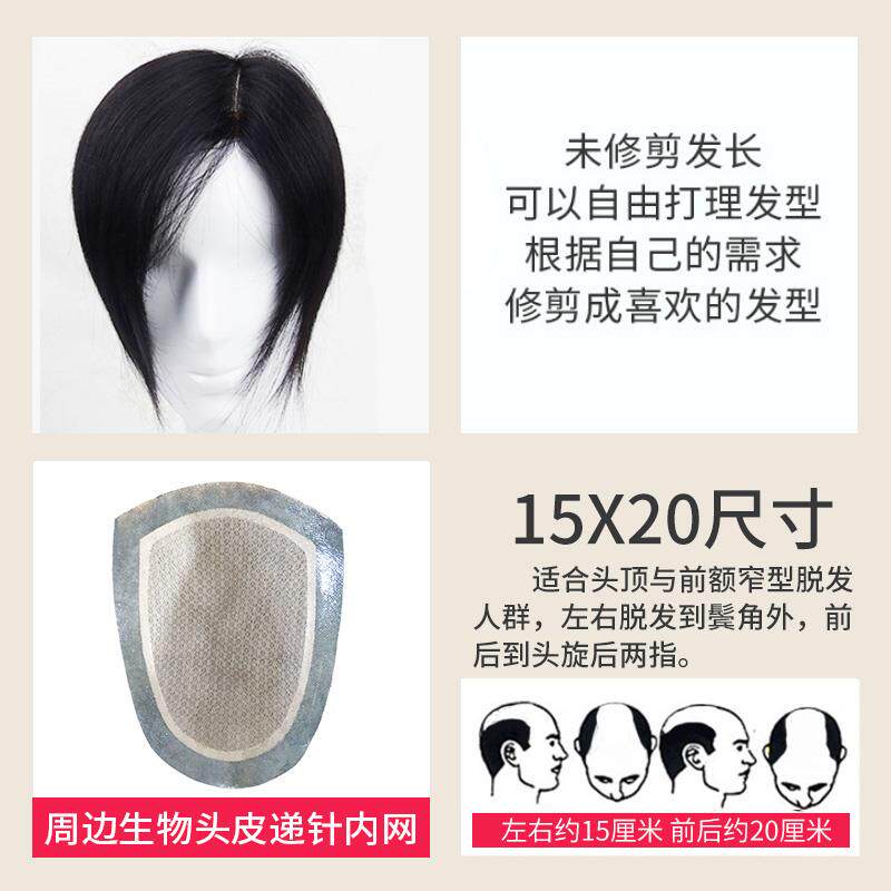 正品男生无痕递针真假发块假发男士补片发假发男短发头顶发片发顶