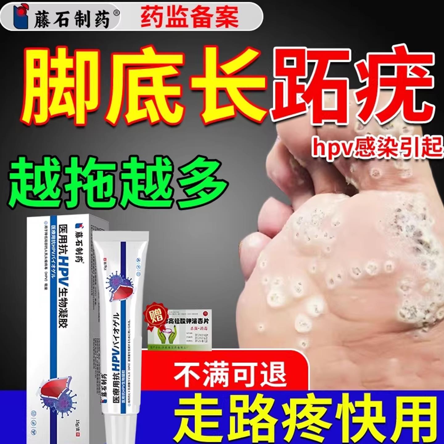 跖疣膏专去用膏寻常疣根病毒拓趾足部根立净疣去除脚底药房同售CA