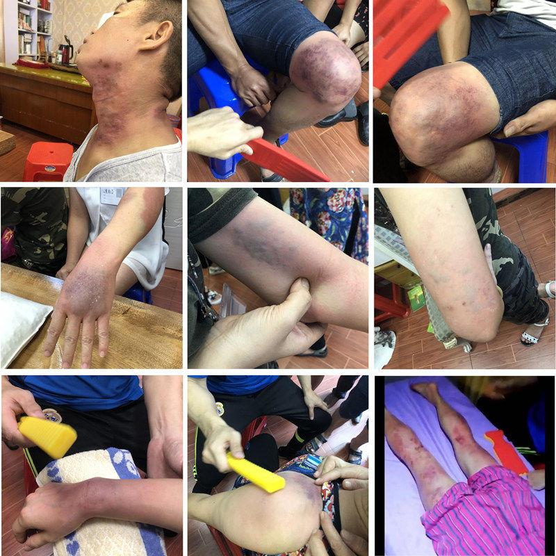 小龙师傅爱心拍硅胶拍痧板按摩捶背器经络拍痧掌养生敲打锤大黄棒