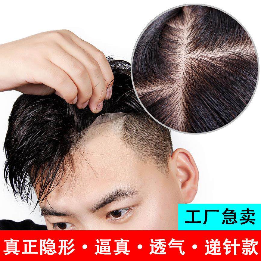 男士真发双递针头顶补发片彷真头皮高端假发男前额无痕隐形假发片