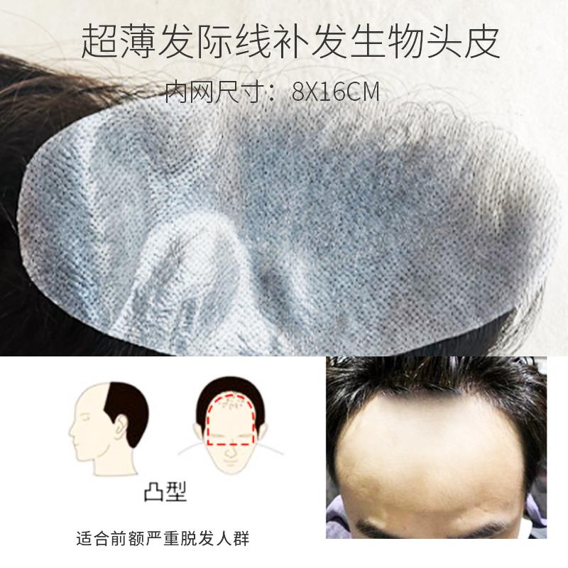 男额发际线假发贴假刘海前额m型刘海生发物前头皮补片士隐TTW形无