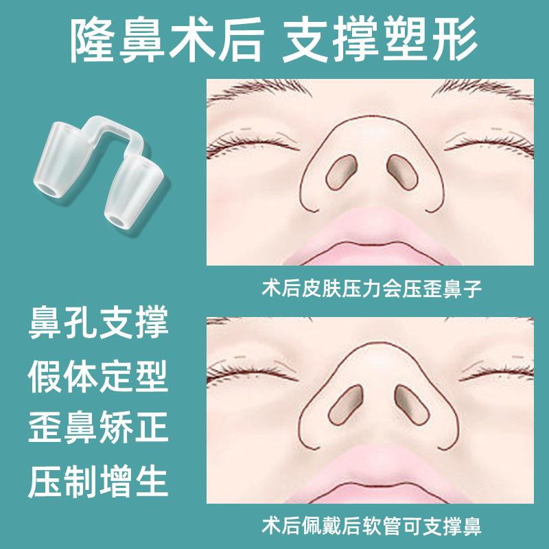 隆鼻器术后支撑矫正器鼻孔撑开防变形固定器假体定型塑形鼻撑神器图片