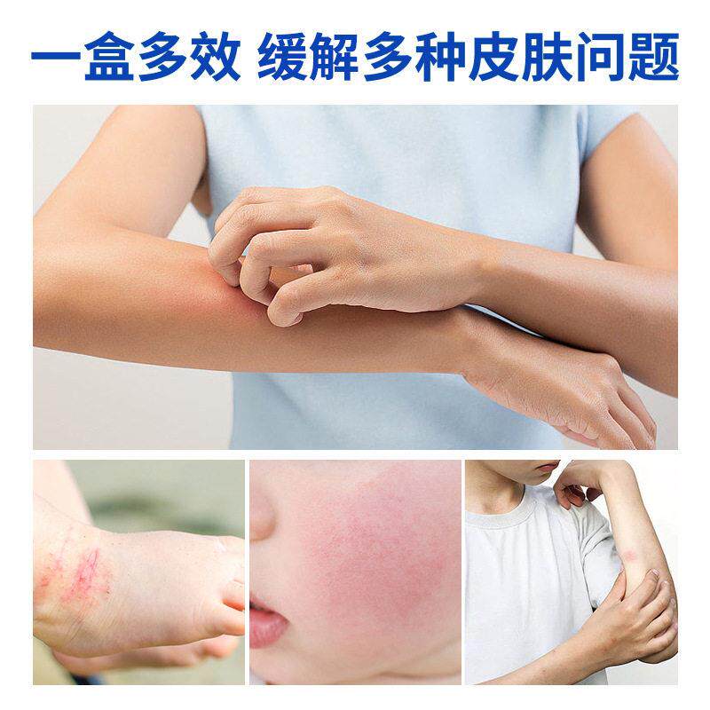 【买2发】泰林贡嘎雪猪油皮肤外用抑菌乳膏缓解不皮王肤适旗舰PJM