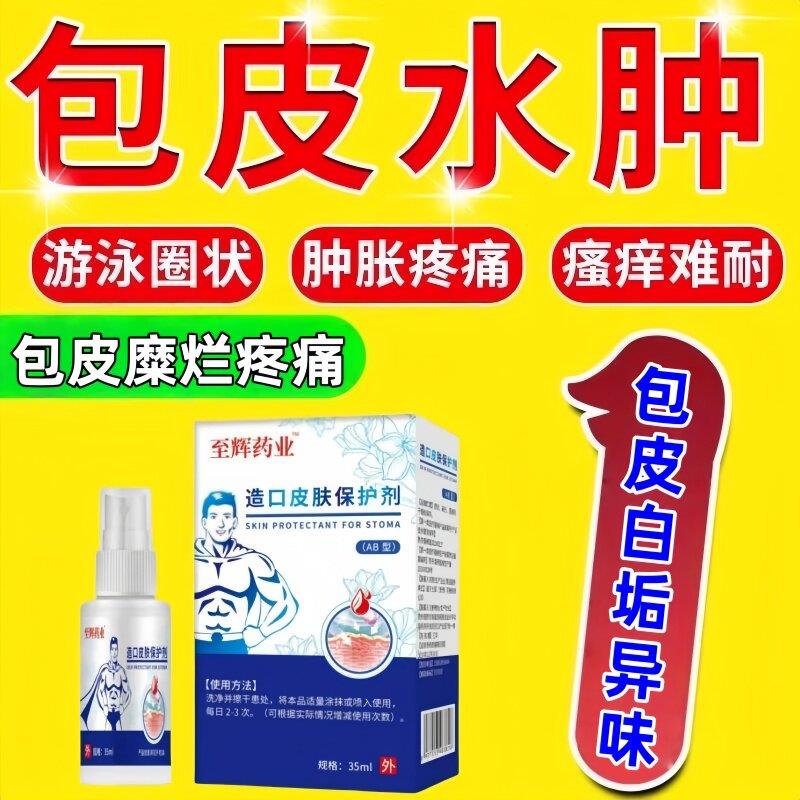 包皮术后水肿疼痛炎症茎真菌感染发炎溃阴烂红肿搭配专用喷剂华维