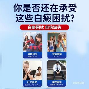 旗舰店官方正品迮川医生补骨脂酊白斑软膏白癜白斑外用膏促黑色素