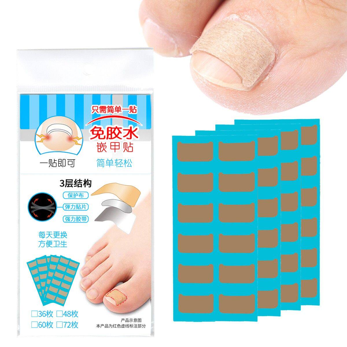 第三代强力果冻胶超粘免胶水正甲贴嵌甲贴双面胶嵌甲矫正器甲沟疼