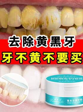 牙粉 去牙渍除口臭清新口腔亮白洗牙粉去黄去烟渍炫白去牙垢