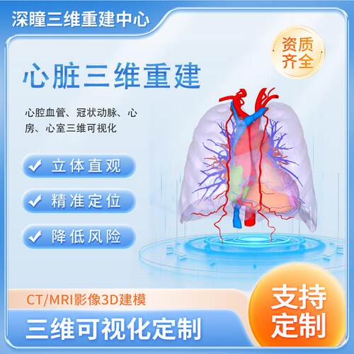 心脏CT三维重建DICOM文件影像医学影像三维可视化3D打印mimics