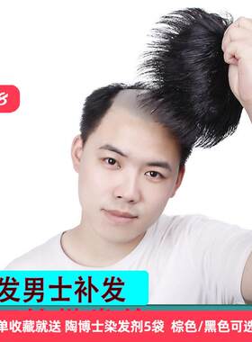 女士补发片假发套头顶补发前额秃顶补发垫接发翻盖假发真发发块