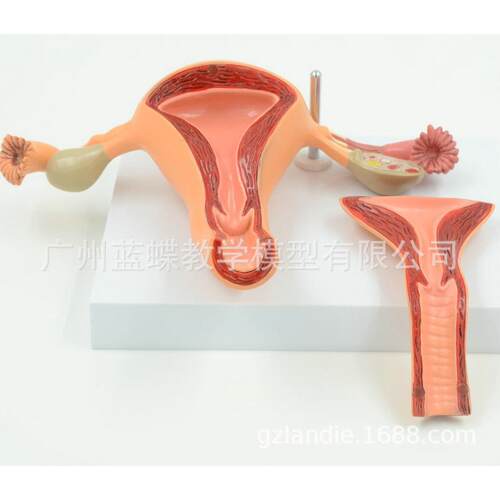 人体模型女性生殖子宫模型阴道卵巢模型教学模具病理变化科学教具