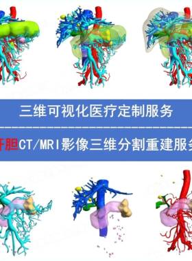 Mimics肝胆CT MRI医学三维重建DICOM影像STL NII三维可视化3D打印