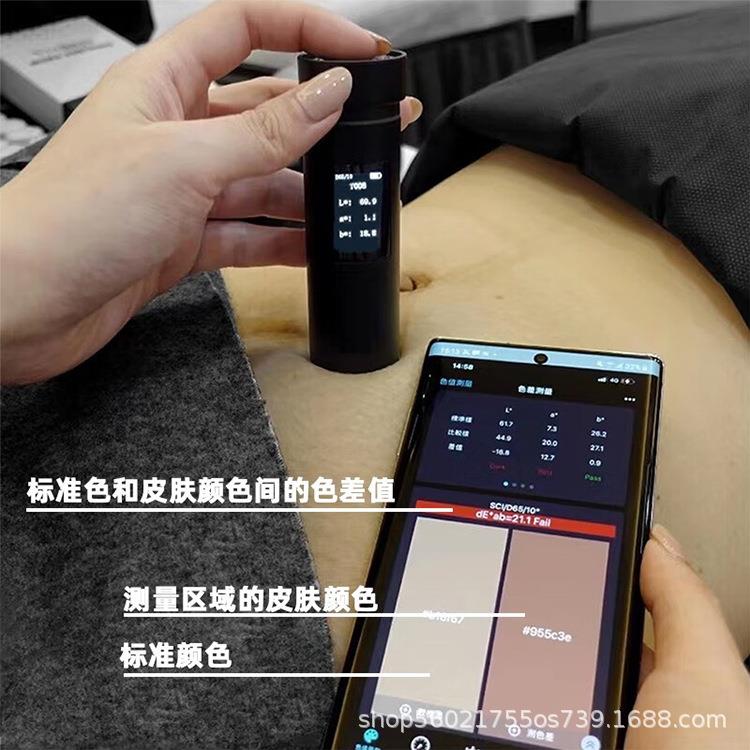 肤色重建术 皮肤测色仪 色差宝生长纹妊娠纹半遮盖术测肤仪
