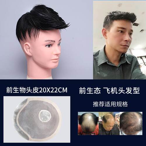 新款织发发假男补士头顶短发块真发假发片秃顶无痕隐形前发额地中