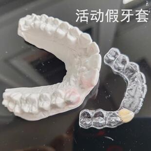 门牙假牙套牙仿真牙齿贴面全瓷牙贴片遮盖缺牙神器临时遮丑牙套