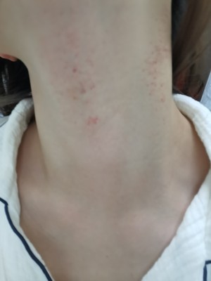 玛瑞莎去颈纹按摩仪导入仪神器怎么样？被忽然给好评后，发现后悔了？
