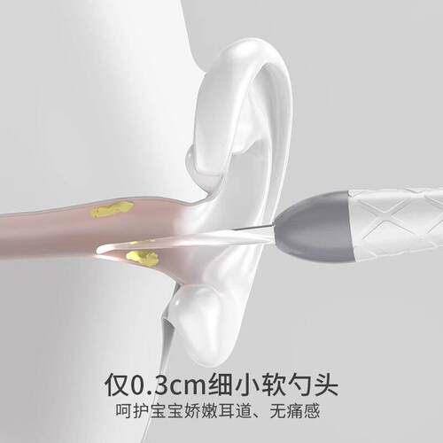 德系可视挖耳勺掏耳发光儿童宝宝专用工具带灯扣耳朵耳屎镊子