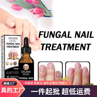 EELHOE Nail Fungus Repair Liquid Thickens and Brightens Nail
