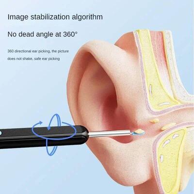 Visual Ear Wax Cleaner with Camera Safe Earwax Removal Endos