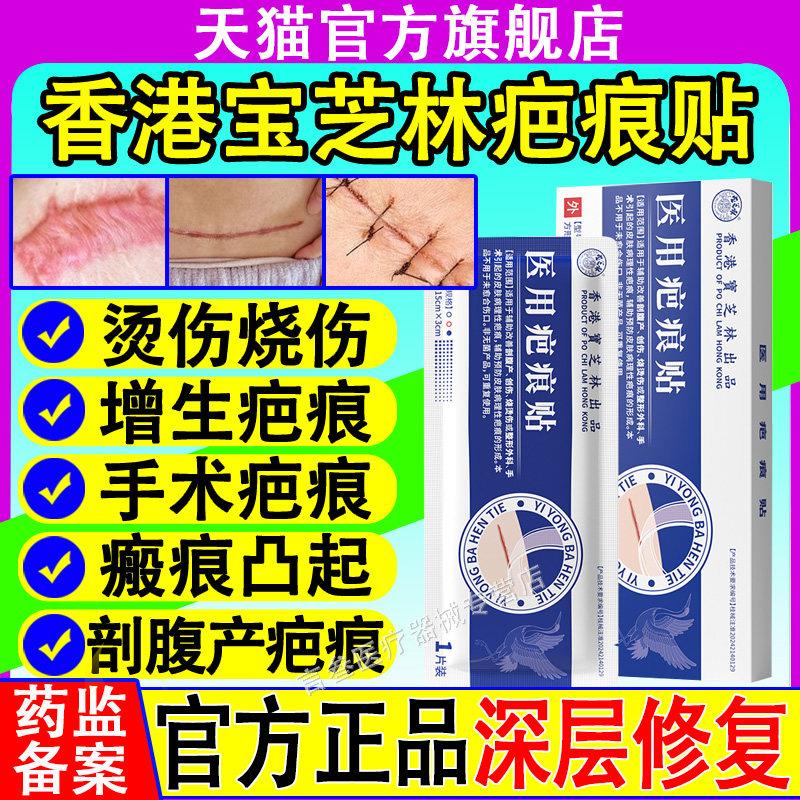 香港宝芝林用疤痕贴剖医腹产术后伤口修复防水去除减张硅酮凝胶贴