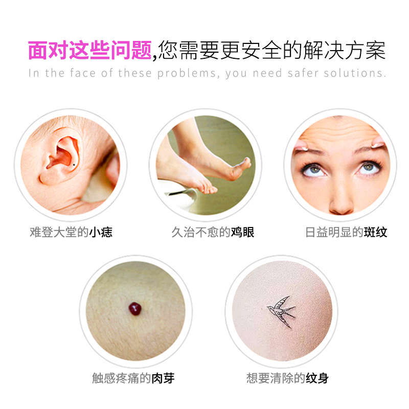 精品激光点痣笔家用美容仪器美容院专用祛斑笔机充电式洗眉机洗纹