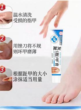指香港大房灰药趾甲膏抑菌膏指甲厚脚趾指甲膏护STD足部理正品旗