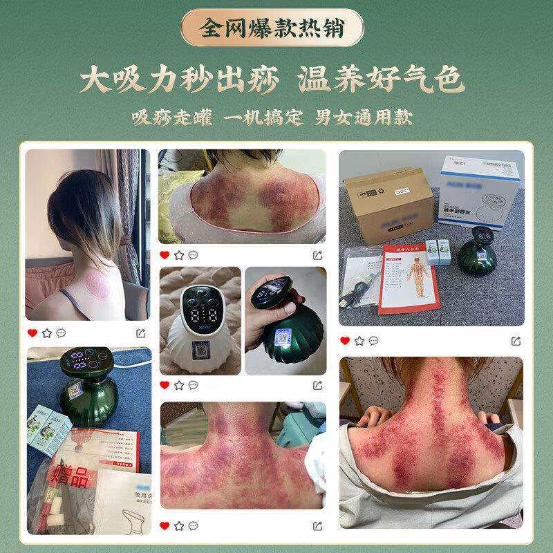 电动刮痧痧仪拔罐电动经络刷筋疗仪通器器吸痧用全身家用按摩刮板