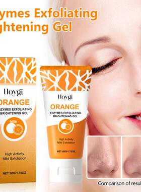 Hoygi Exfoliating Blackhead Gel - Gently exfoliates, removes