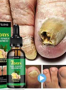 7 Days Nail Fungal Treatment Essence Oil Foot Toe Nail Fungu