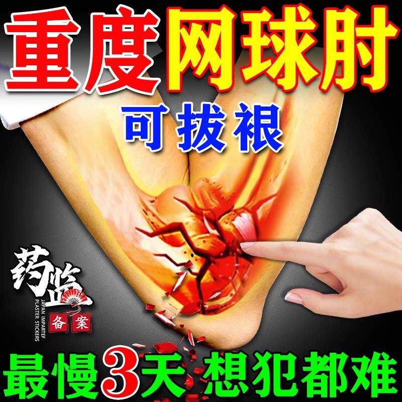网球肘专用膏药护肘肱骨外上髁炎手臂肘关节疼痛医用理疗热敷药贴