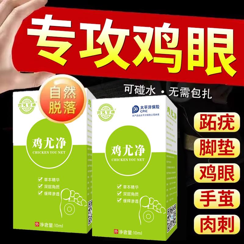 茧尤净鸡眼抑菌液体颈部瘊子脚垫肉刺手茧疙瘩疣灵专用疣立清药水