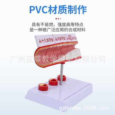 仿真人体冠状动脉性心血管动脉模型硬化模型老年心脏模型血栓模型