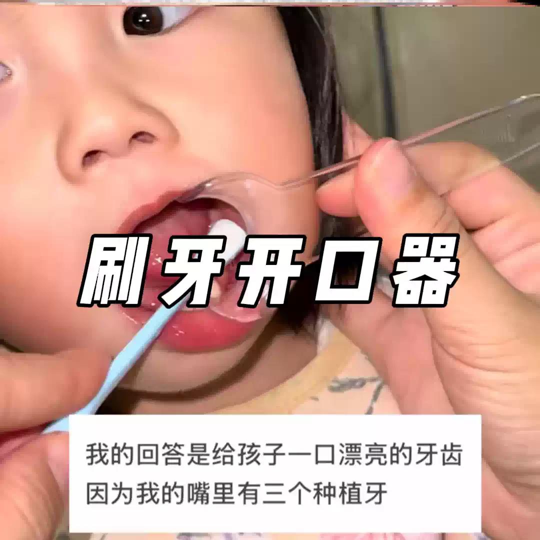 宝宝刷牙辅助器防咬嘴巴扩张器开口刷牙扩嘴神器带手柄训练器儿童图片
