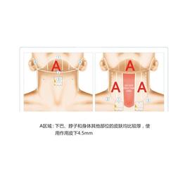 美臣热玛家用脸部美容仪抗皱提拉提升紧致逆龄去眼袋童颜机射频仪