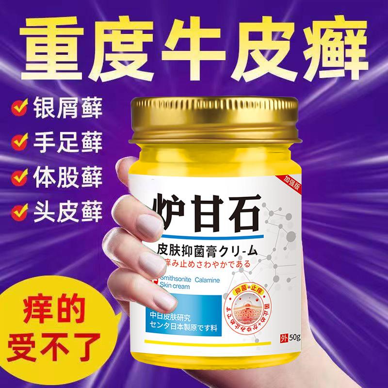 日本进口止王炉甘石皮肤瘙痒止痒膏皮肤痒干燥痒抑全身天然草本相
