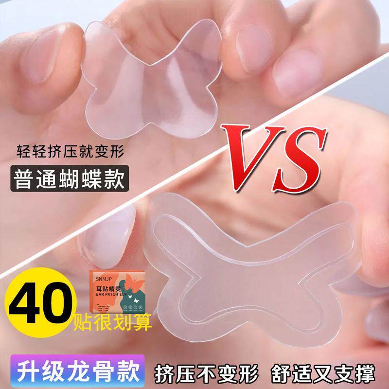 snmjp龙骨蝴蝶款精灵耳珠隐形不痛强支撑贴面耳矫正招风耳显脸小