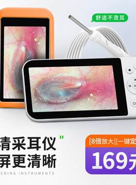 可视采耳仪器高清摄像内视镜掏耳朵儿童专用挖耳勺工具3.2mm监视
