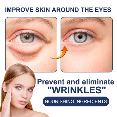 OUHOE Eye Firming and Lifting Cream - Reduces Dark Circles,